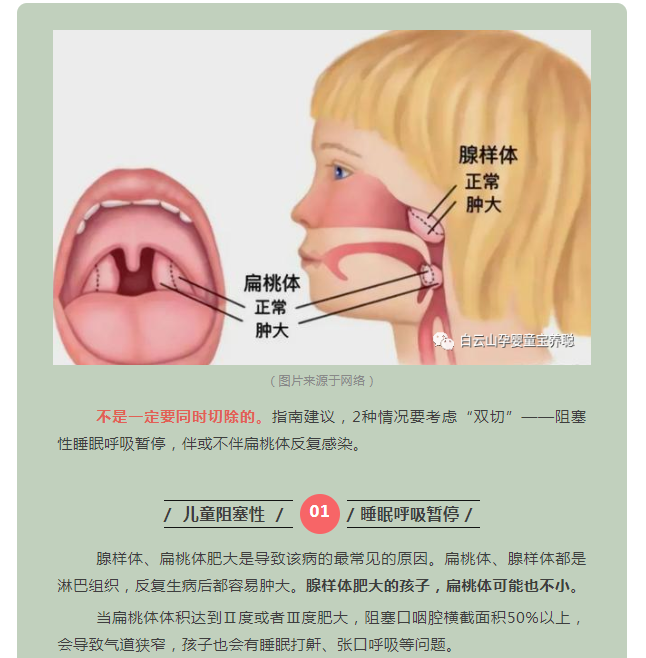 【宝养聪分享】扁桃体腺样体一定要都切吗？切除扁桃体会影响免疫力吗？